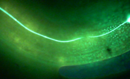 A severed nerve cell - microscopic roundworm species C. elegans can mend severed nerve cells through a process called axonal fusion. A severed nerve cell - microscopic roundworm species C. elegans can mend severed nerve cells through a process called axonal fusion.